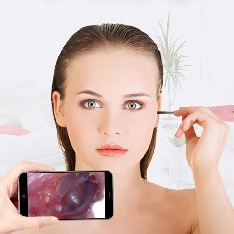 A2 WiFi Endoscope Camera 720P Ear Cleaning Wireless Safe Ear Pick Tool Visual Ear Spoon, Diameter: 4.4mm(Pink) - Image 8