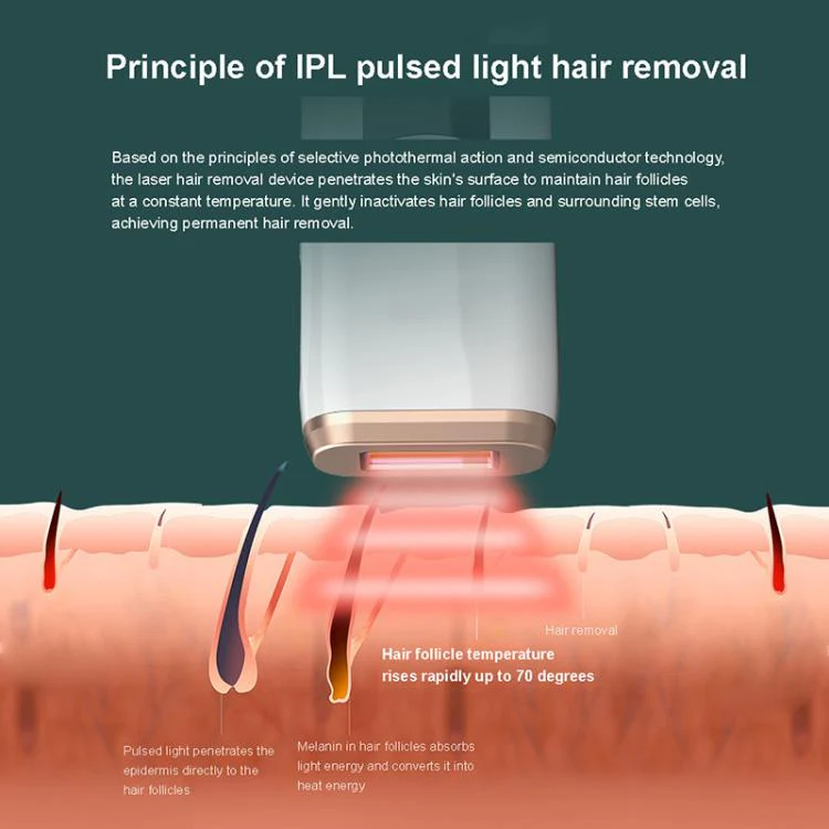 AI09 IPL Electric Hair Removal Device, Plug Type:US Plug(White) - Image 6