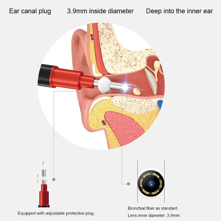 Bebird B1 Intelligent HD Visual Ear Cleaner Earwax Tool, Standard Version(Rose Gold) - Image 10