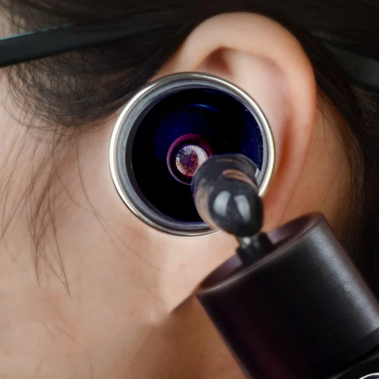 Ear Cleaning Hand Lamp USB Charging Otoscope(Rose Gold) - Image 7