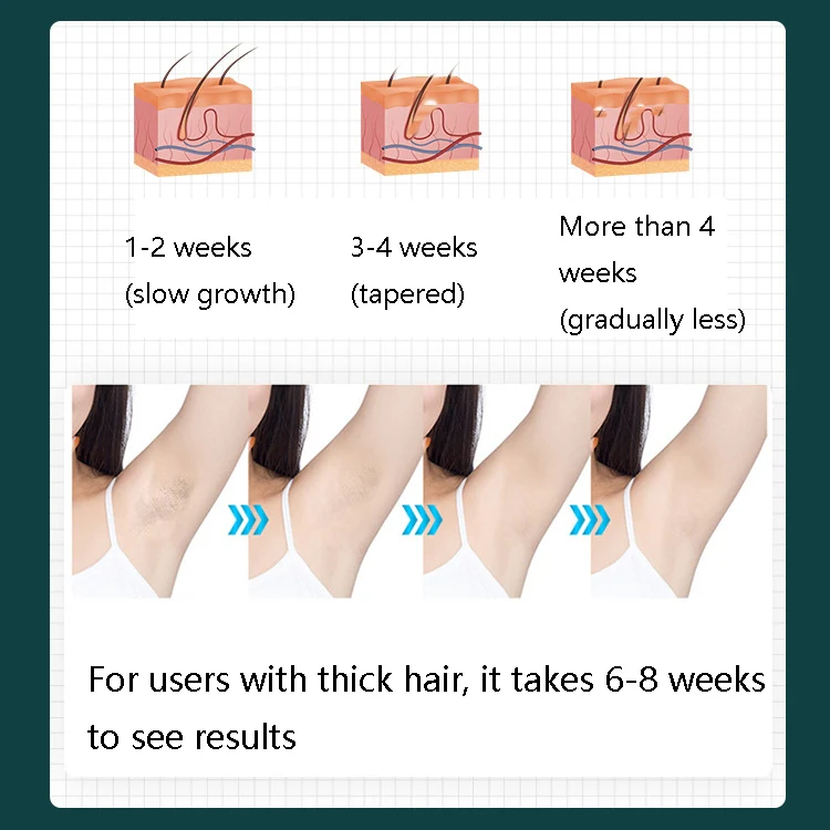 FY-B500 Laser Hair Removal Equipment Household Electric IPL Hair Removal Machine, Plug Type:AU Plug(Black) - Image 6