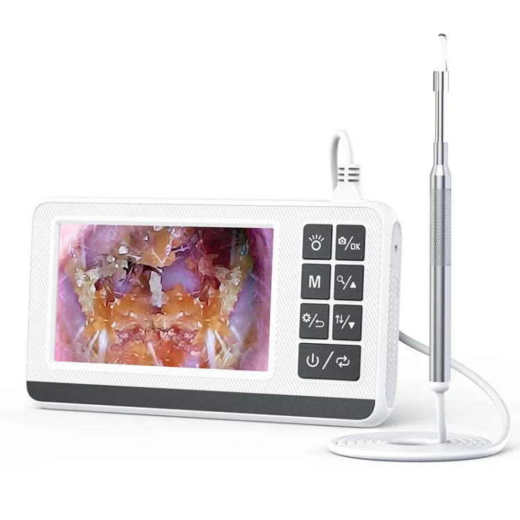 P60 4.3 inch IPS HD Screen Smart Visual Otoscope Ear Pick(White)